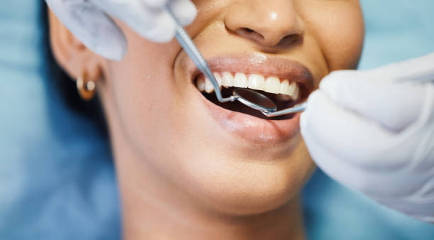 Best Emergency Wisdom Teeth Removal in Buffalo, OK